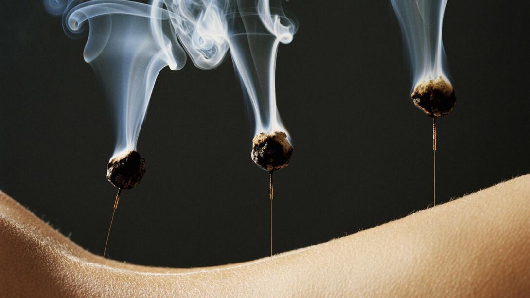Neurobiological Mechanisms of Acupuncture for Some Common Illnesses: A Clinician’s Perspective