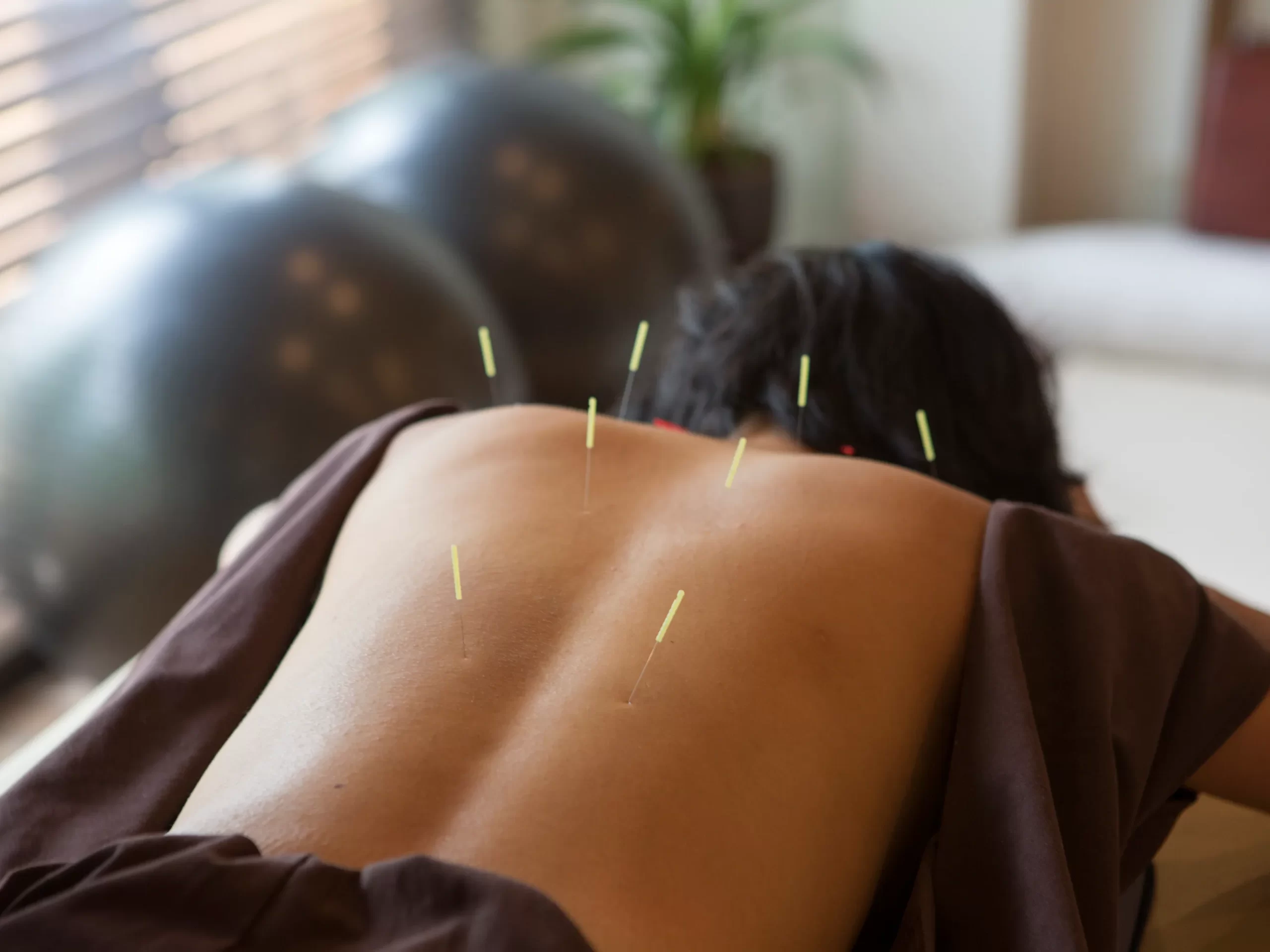 Acupuncture into the Future